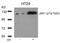 Janus Kinase 1 antibody, 79-173, ProSci, Western Blot image 