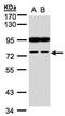 Fibronectin Type III And SPRY Domain Containing 2 antibody, TA309050, Origene, Western Blot image 