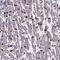 Retinal Degeneration 3 Like antibody, HPA067971, Atlas Antibodies, Immunohistochemistry paraffin image 