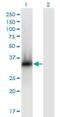 Zinc Finger Protein 511 antibody, H00118472-M06, Novus Biologicals, Western Blot image 