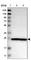 Nucleoporin 35 antibody, HPA018401, Atlas Antibodies, Western Blot image 