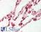 Fanconi anemia group C protein antibody, LS-B11834, Lifespan Biosciences, Immunohistochemistry paraffin image 