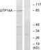 UTP14A Small Subunit Processome Component antibody, GTX87543, GeneTex, Western Blot image 