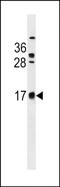 Chromosome 2 Open Reading Frame 83 antibody, PA5-72055, Invitrogen Antibodies, Western Blot image 