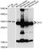 Carbonic anhydrase 13 antibody, A14467, ABclonal Technology, Western Blot image 