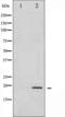 SNCA antibody, TA325866, Origene, Western Blot image 