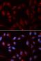 NPC Intracellular Cholesterol Transporter 2 antibody, LS-C334047, Lifespan Biosciences, Immunofluorescence image 
