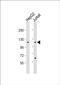 Alpha-mannosidase 2C1 antibody, PA5-49241, Invitrogen Antibodies, Western Blot image 