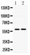 Diacylglycerol O-acyltransferase 1 antibody, PA5-79150, Invitrogen Antibodies, Western Blot image 