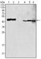 Glutamic-Oxaloacetic Transaminase 2 antibody, AM06383SU-N, Origene, Western Blot image 