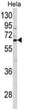 CTP Synthase 2 antibody, AP17959PU-N, Origene, Western Blot image 