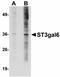 ST3 Beta-Galactoside Alpha-2,3-Sialyltransferase 6 antibody, LS-C108518, Lifespan Biosciences, Western Blot image 