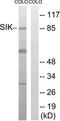 Salt Inducible Kinase 1 antibody, TA316162, Origene, Western Blot image 