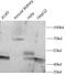 Alpha-(1,6)-fucosyltransferase antibody, FNab03251, FineTest, Western Blot image 