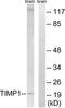 TIMP Metallopeptidase Inhibitor 1 antibody, TA326267, Origene, Western Blot image 