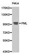 Promyelocytic Leukemia antibody, orb191472, Biorbyt, Western Blot image 