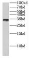 Family With Sequence Similarity 92 Member A antibody, FNab02999, FineTest, Western Blot image 