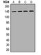 Valyl-TRNA Synthetase antibody, LS-C668088, Lifespan Biosciences, Western Blot image 