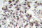 Programmed Cell Death 4 antibody, LS-C176644, Lifespan Biosciences, Immunohistochemistry frozen image 