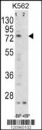 Folliculin antibody, 63-573, ProSci, Western Blot image 
