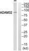 ADAM Metallopeptidase Domain 32 antibody, abx014154, Abbexa, Western Blot image 