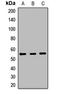 Protein O-Mannosyltransferase 1 antibody, LS-C668524, Lifespan Biosciences, Western Blot image 