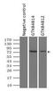 B-Raf Proto-Oncogene, Serine/Threonine Kinase antibody, GTX84812, GeneTex, Immunoprecipitation image 