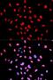 Bruton Tyrosine Kinase antibody, LS-C335791, Lifespan Biosciences, Immunofluorescence image 
