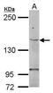 Telomerase Reverse Transcriptase antibody, PA5-32195, Invitrogen Antibodies, Western Blot image 