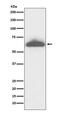 Retinoid Isomerohydrolase RPE65 antibody, M00824, Boster Biological Technology, Western Blot image 