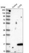 Colipase antibody, PA5-52699, Invitrogen Antibodies, Western Blot image 
