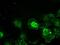 TYRO3 Protein Tyrosine Kinase antibody, GTX83453, GeneTex, Immunofluorescence image 