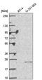 Uridine-Cytidine Kinase 2 antibody, HPA057128, Atlas Antibodies, Western Blot image 