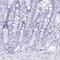 BPI Fold Containing Family A Member 2 antibody, PA5-60583, Invitrogen Antibodies, Immunohistochemistry paraffin image 
