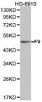 Coagulation Factor IX antibody, TA327088, Origene, Western Blot image 