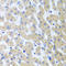 Protein arginine N-methyltransferase 2 antibody, A04706, Boster Biological Technology, Immunohistochemistry paraffin image 