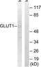 Solute carrier family 2, facilitated glucose transporter member 1 antibody, TA312796, Origene, Western Blot image 