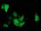 ADP-ribosylation factor GTPase-activating protein 1 antibody, MA5-25466, Invitrogen Antibodies, Immunocytochemistry image 