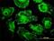 Mitochondrial Ribosomal Protein L12 antibody, H00006182-M01, Novus Biologicals, Immunofluorescence image 