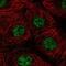 Zinc finger protein ZIC 1 antibody, NBP1-86833, Novus Biologicals, Immunocytochemistry image 