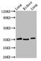 Homeobox D1 antibody, LS-C674125, Lifespan Biosciences, Western Blot image 