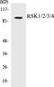 Ribosomal Protein S6 Kinase A1 antibody, EKC1508, Boster Biological Technology, Western Blot image 