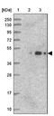 Armadillo Repeat Containing 6 antibody, NBP1-81179, Novus Biologicals, Western Blot image 