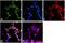 Ubiquitin carboxyl-terminal hydrolase CYLD antibody, 43-7700, Invitrogen Antibodies, Immunofluorescence image 