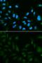 Epididymal Peptidase Inhibitor antibody, GTX53988, GeneTex, Immunofluorescence image 