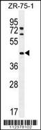 Methyltransferase Like 2A antibody, TA324450, Origene, Western Blot image 