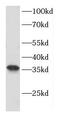 Cyclin N-Terminal Domain Containing 1 antibody, FNab01819, FineTest, Western Blot image 