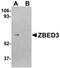 Zinc Finger BED-Type Containing 3 antibody, TA306755, Origene, Western Blot image 