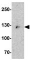 Cardiomyopathy Associated 5 antibody, GTX32021, GeneTex, Western Blot image 