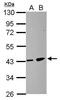 Zinc Finger DHHC-Type Containing 11 antibody, PA5-28503, Invitrogen Antibodies, Western Blot image 